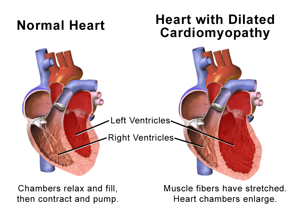 5 Ways Alcohol Affects Your Heart EarthFIT